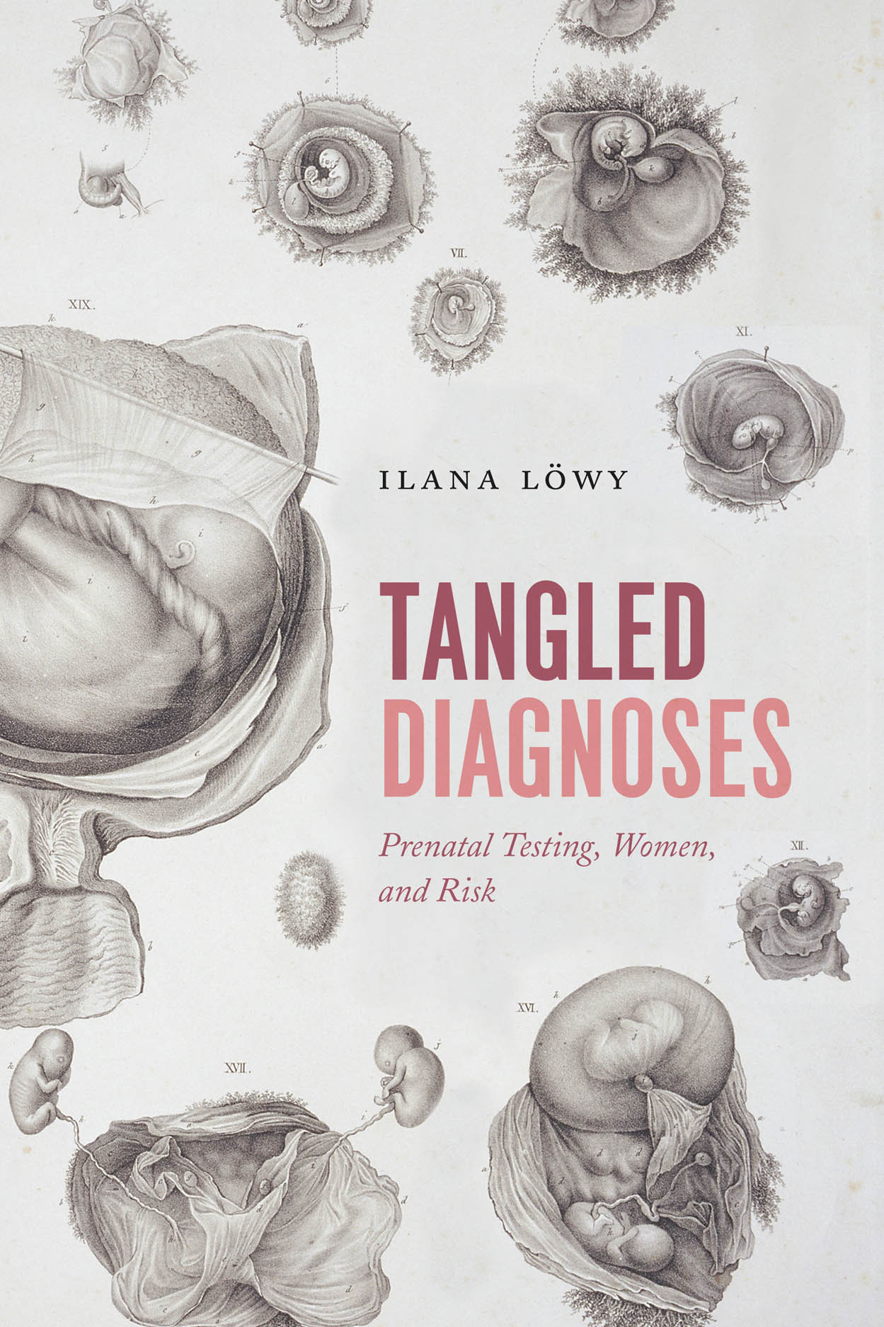 Tangled Diagnoses: Prenatal Testing, Women, and Risk (2018) (PDF) Ilana Löwy